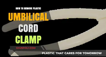 Safe and Gentle Steps to Remove Plastic Umbilical Cord Clamp