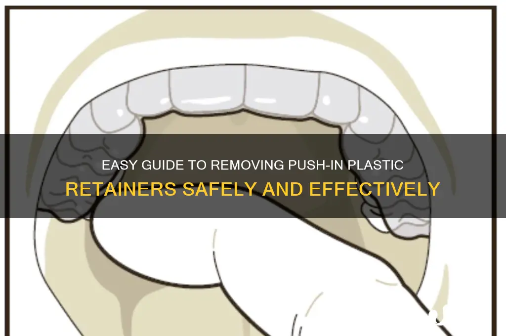 how to remove push in plastic retainers