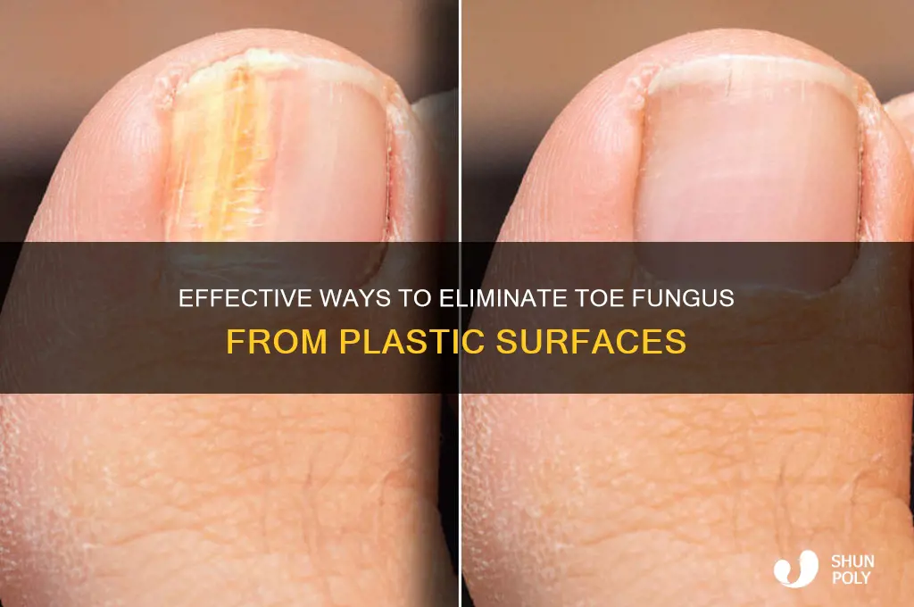 how to remove toe fungus from plastic
