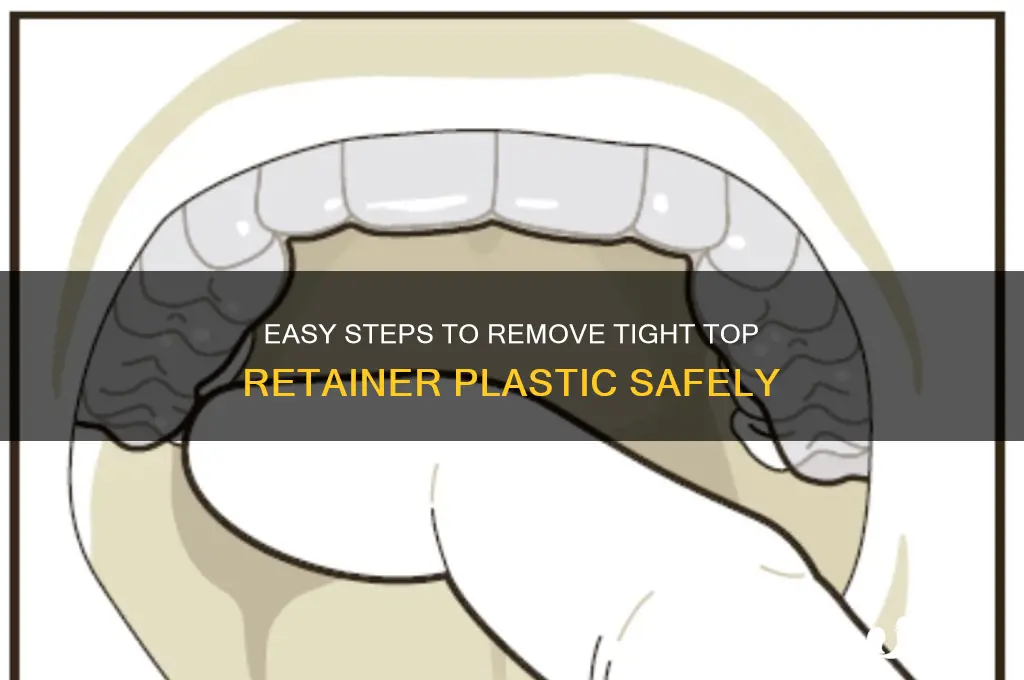 how to remove top retainer plastic tight