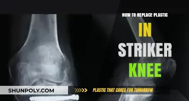 Striker Knee Surgery: Replacing Plastic, Step by Step