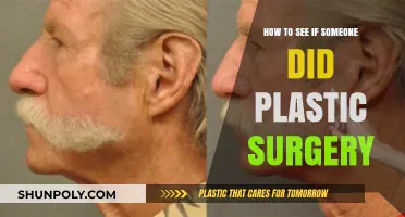 Spotting Plastic Surgery: Key Signs and Subtle Clues to Look For