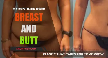 Identifying Enhanced Curves: Spotting Breast and Butt Plastic Surgery Signs