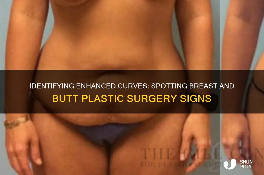 how to spot plastic surgery breast and butt