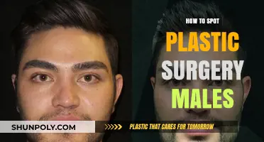 Spotting Male Plastic Surgery: Key Signs and Subtle Clues