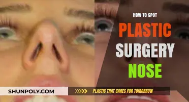 Identifying Rhinoplasty: Key Signs of a Surgically Enhanced Nose