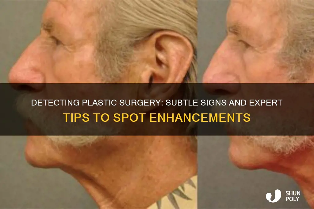 how to spot plastic surgery