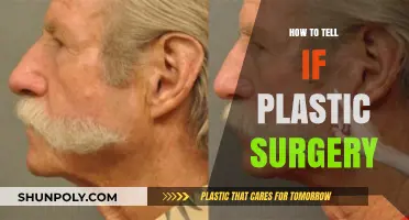 Spotting Plastic Surgery: Subtle Signs and Telltale Clues to Look For