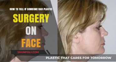 Spotting Facial Plastic Surgery: Subtle Signs and Clues to Look For
