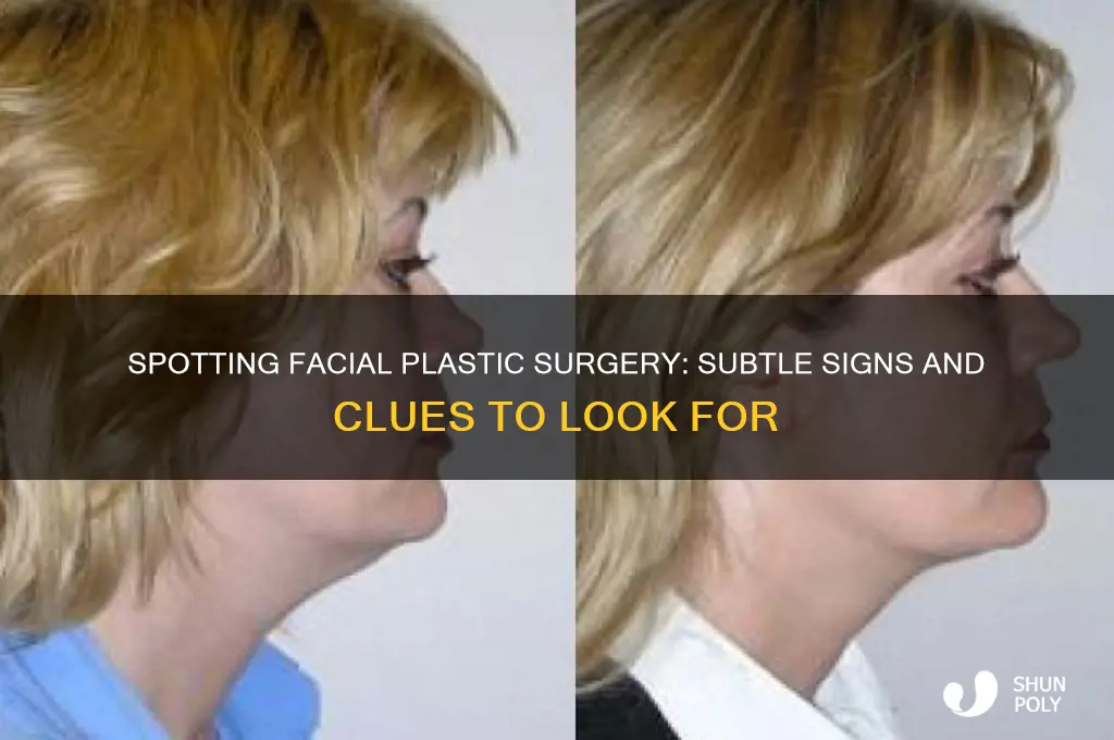 how to tell if someone had plastic surgery on face