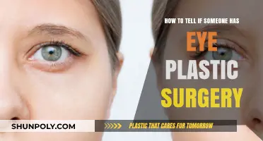 Spotting Eye Plastic Surgery: Key Signs and Subtle Clues