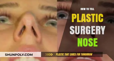 Spotting Plastic Surgery: Signs of a Rhinoplasty Nose