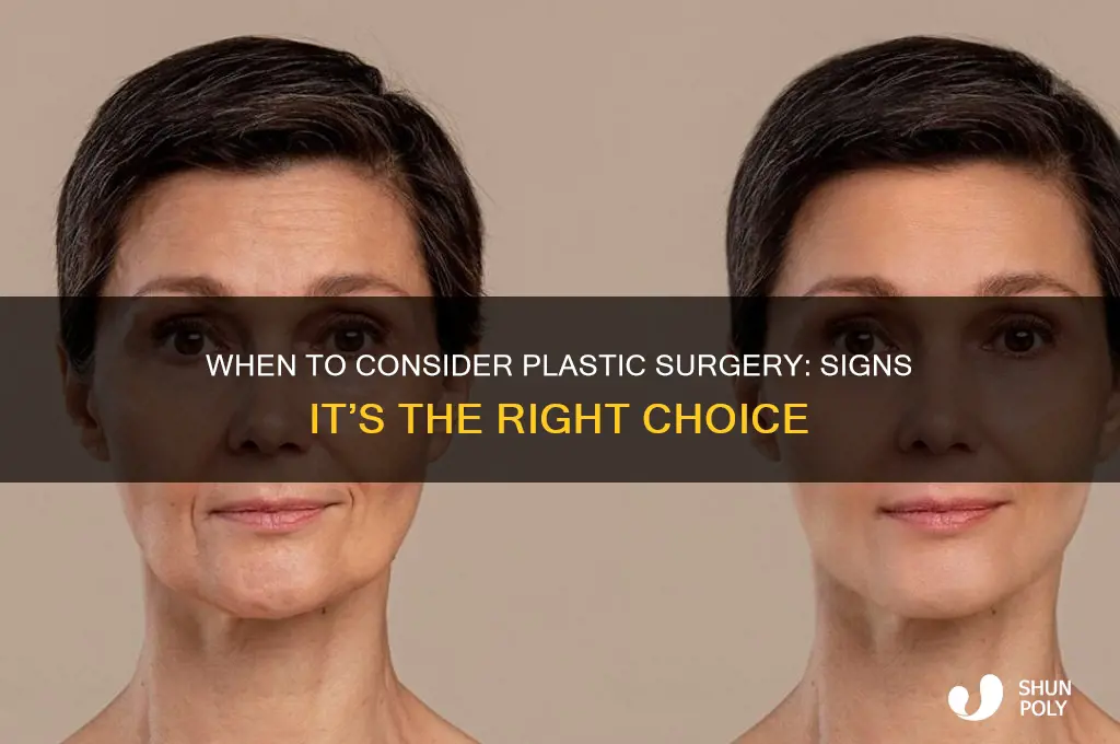 how to tell when you should have plastic surgery
