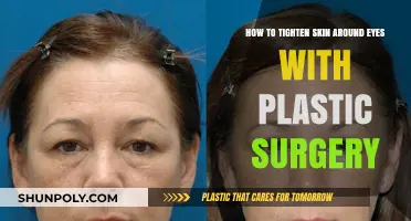 Effective Eye Lift Surgery Techniques for Firmer, Youthful Skin Around Eyes