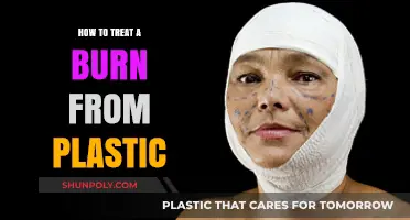 Treating Burns: Plastic Injuries and Effective Home Remedies