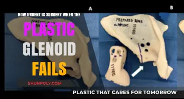 Glenoid Plastic Failure: Assessing the Urgency of Surgical Intervention