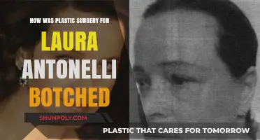 Laura Antonelli's Tragic Plastic Surgery: The Botched Procedure That Changed Her Life