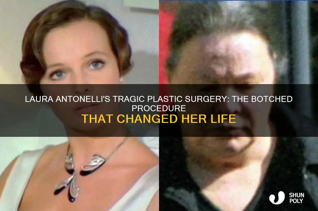 how was plastic surgery for laura antonelli botched