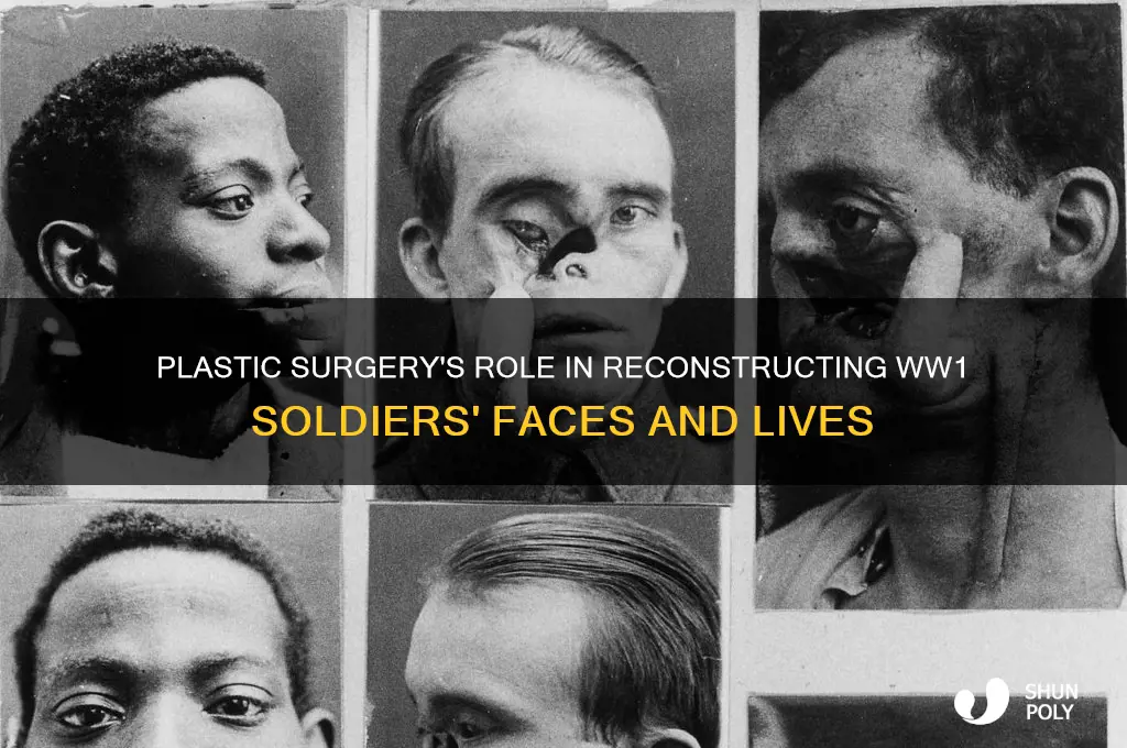 how was plastic surgery used in ww1