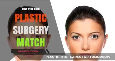 Does Plastic Surgery Meet Expectations? Realistic Outcomes and Patient Satisfaction