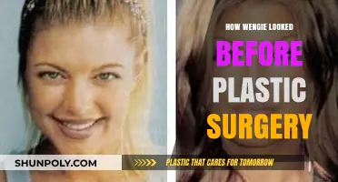 Wengie's Transformation: Unveiling Her Pre-Plastic Surgery Appearance