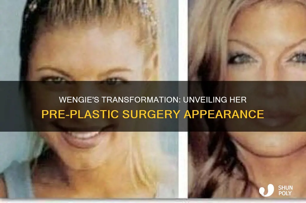 how wengie looked before plastic surgery