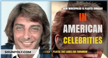 Plastic Surgery Among American Celebrities: How Common Is It?