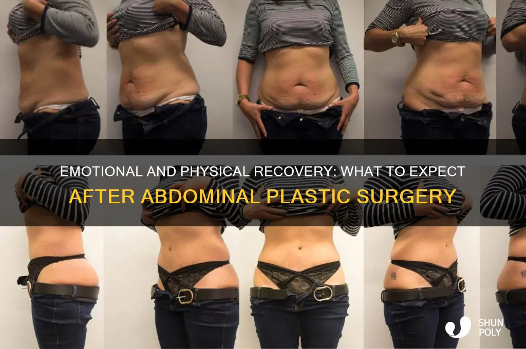 how will i feel after abdominal plastic surgery