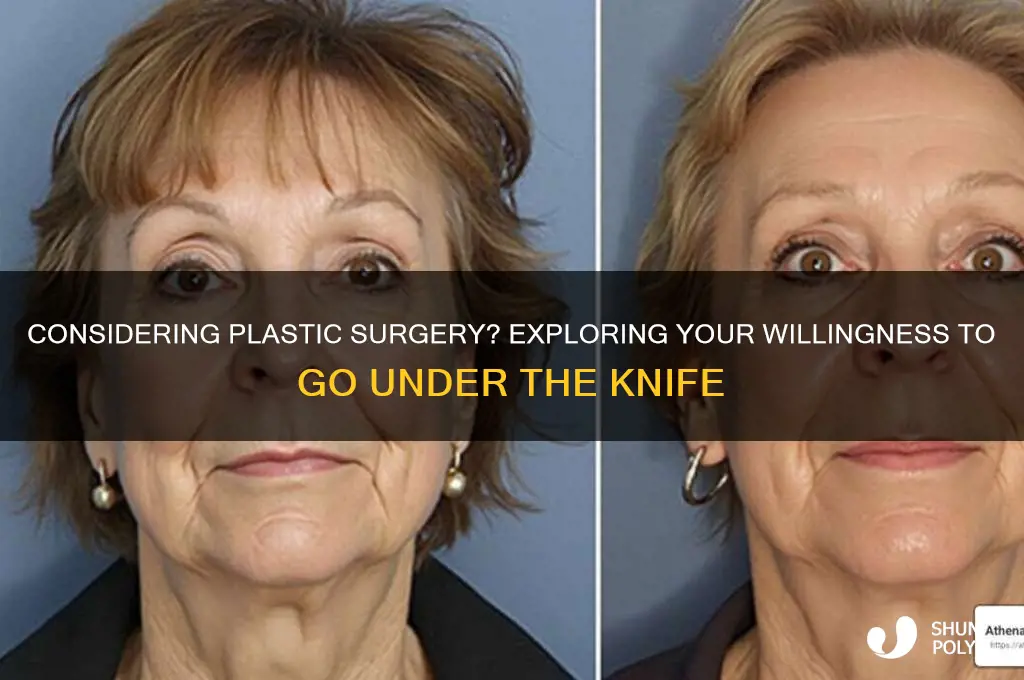how willing are you to get plastic surgery