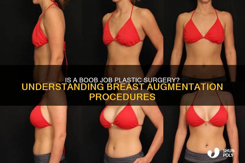 is a boob job plastic surgery