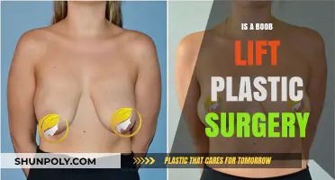 Is a Boob Lift Right for You? Exploring Breast Lift Surgery