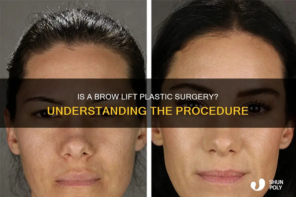 is a brow lift considered plastic surgery
