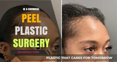 Chemical Peels vs. Plastic Surgery: Understanding the Key Differences
