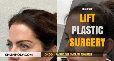 Understanding Facelift Surgery: Benefits, Risks, and Recovery Process