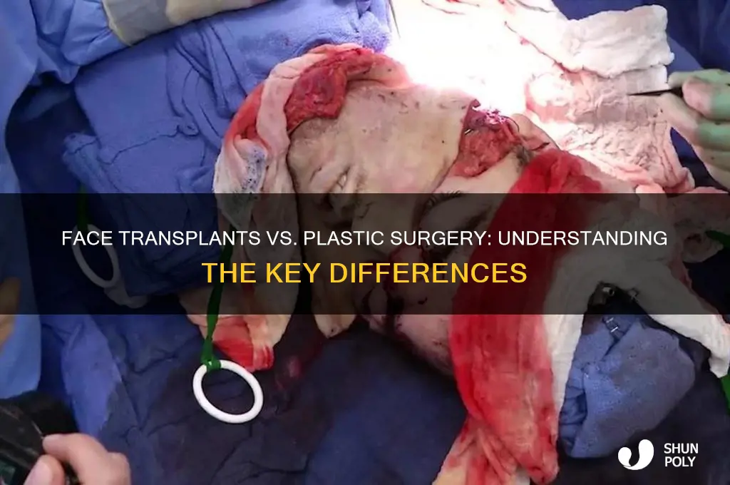 is a face transplant plastic surgery