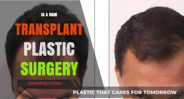 Is a Hair Transplant Considered Plastic Surgery? Exploring the Facts