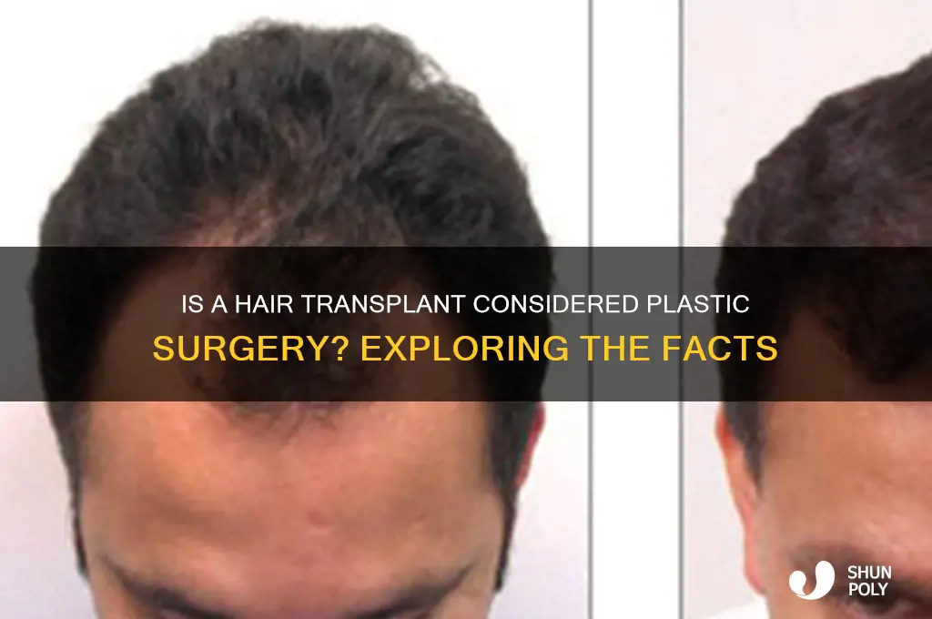 is a hair transplant plastic surgery