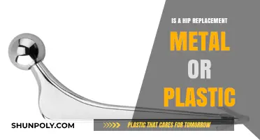 Hip Replacement: Metal or Plastic?