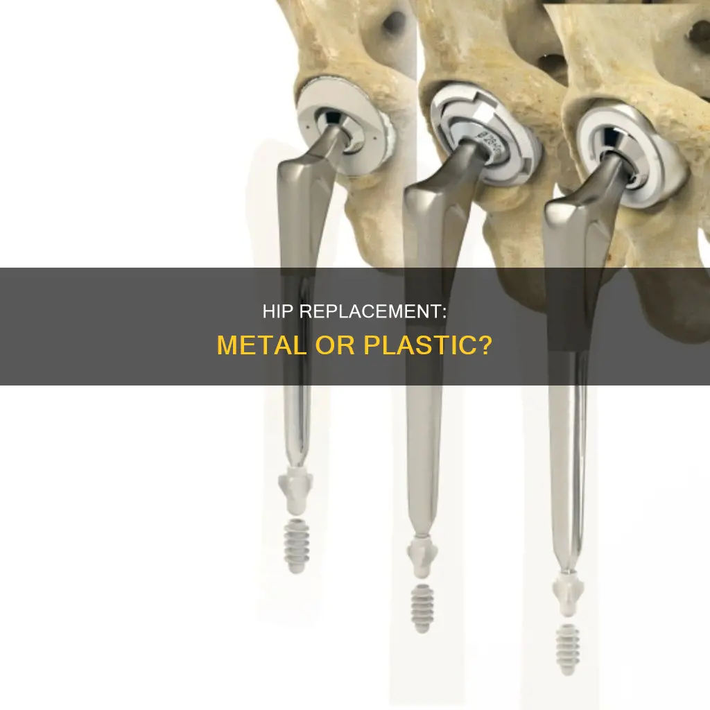is a hip replacement metal or plastic