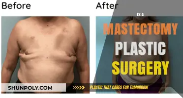 Mastectomy and Plastic Surgery: Reconstructing Bodies, Restoring Confidence