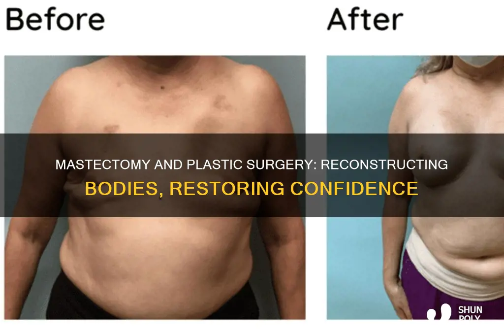 is a mastectomy plastic surgery