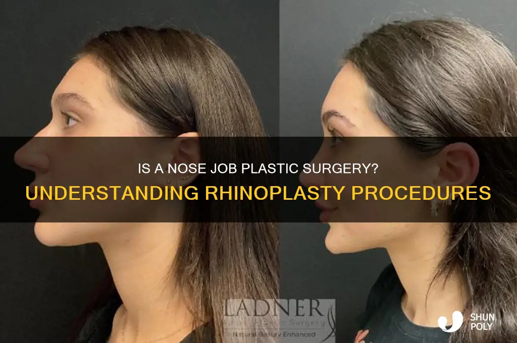 is a nose job considered plastic surgery