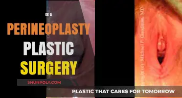 Perineoplasty Explained: Understanding Its Role in Plastic Surgery Procedures