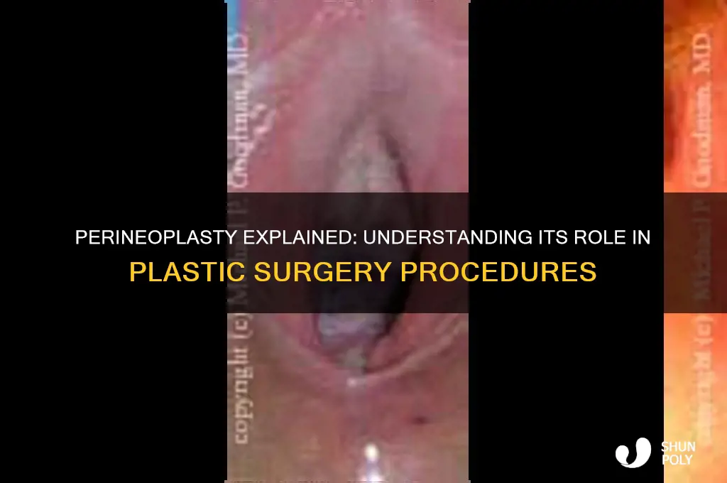 is a perineoplasty plastic surgery