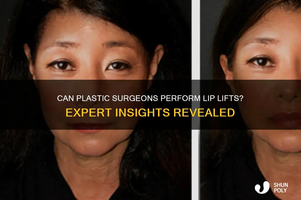 is a plastic surgeon abke to do lip lifts