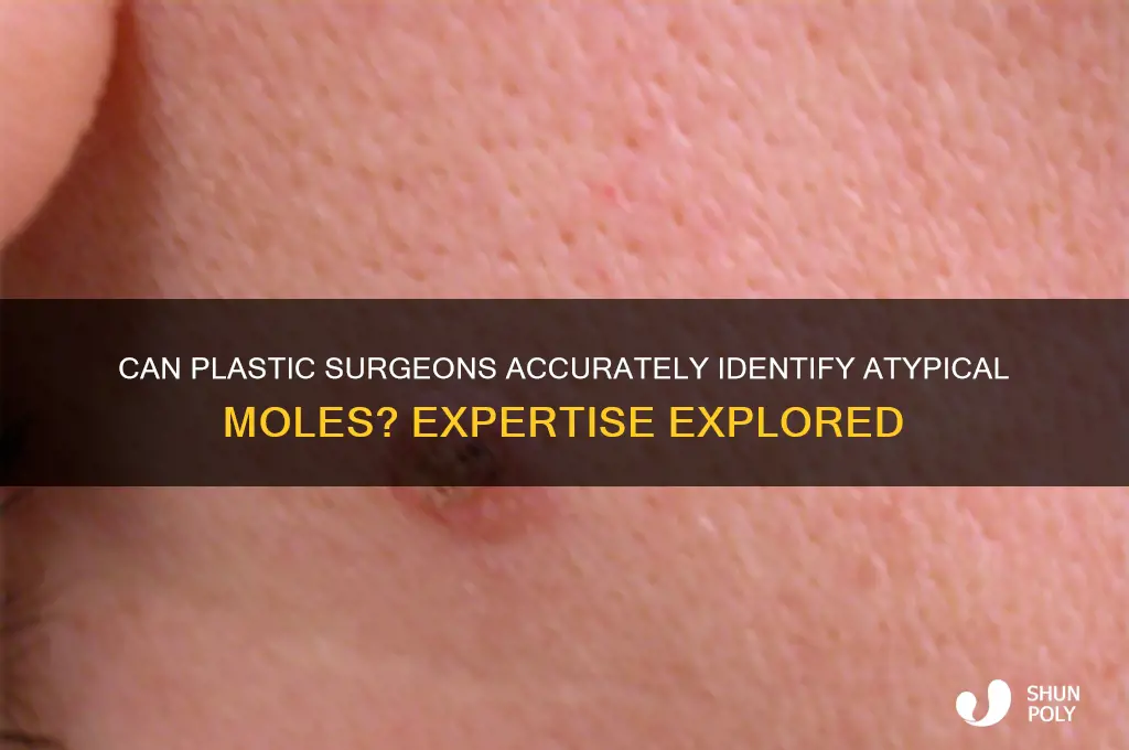 is a plastic surgeon qualified to detect atypical moles