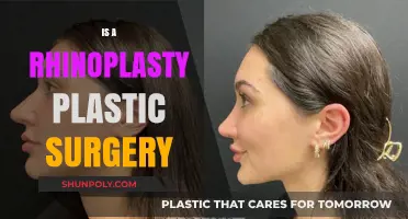 Rhinoplasty Explained: Understanding the Role of Plastic Surgery in Nose Reshaping