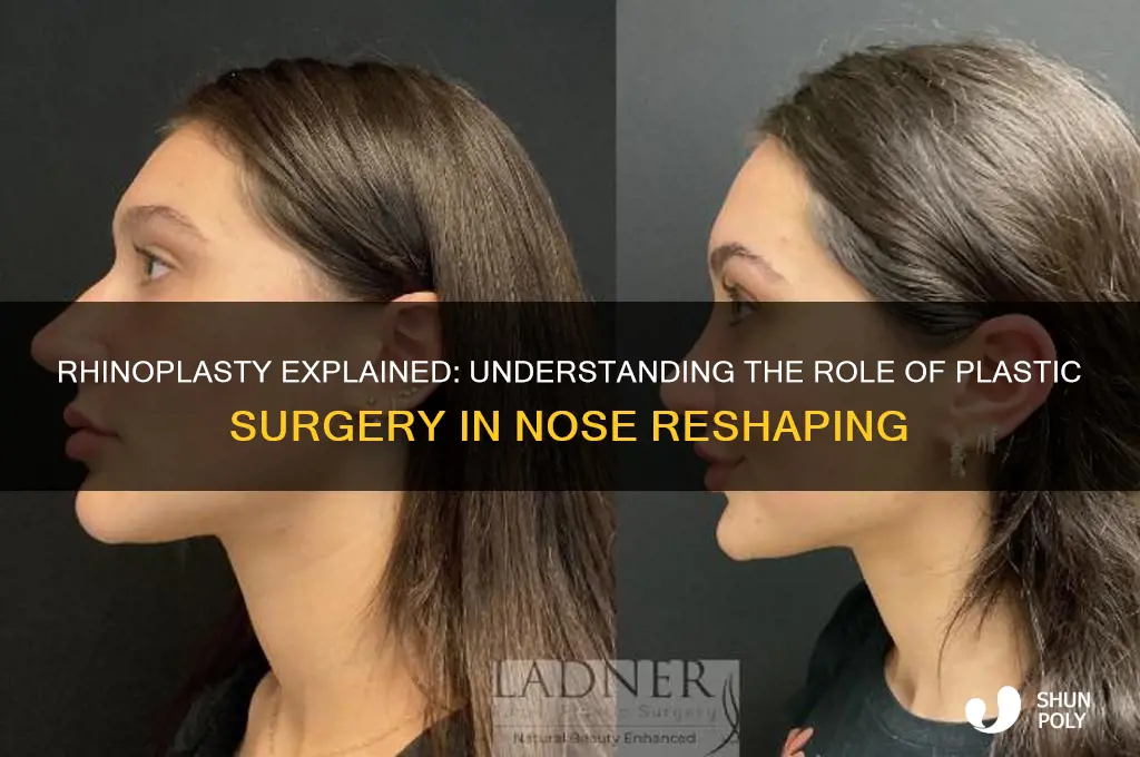 is a rhinoplasty plastic surgery