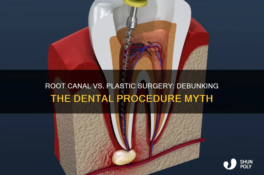 is a root canal plastic surgery