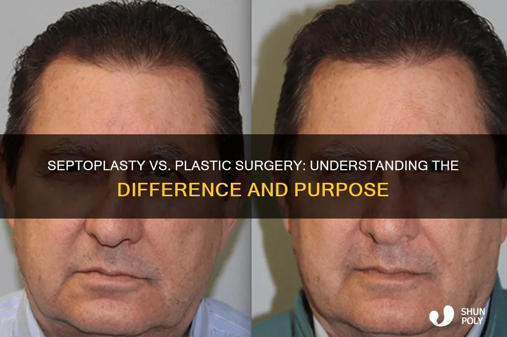 is a septoplasty plastic surgery